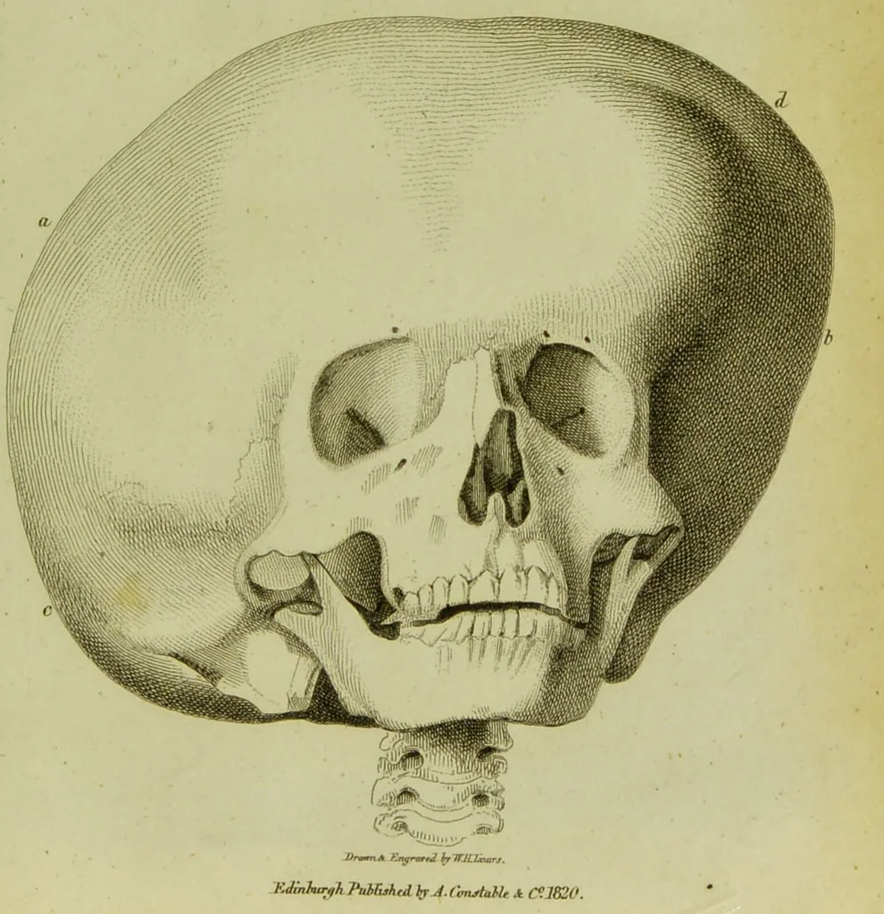 An illustration from Illustrations of phrenology : with engravings / by Sir G. S. Mackenzie., 1820, leaf 305