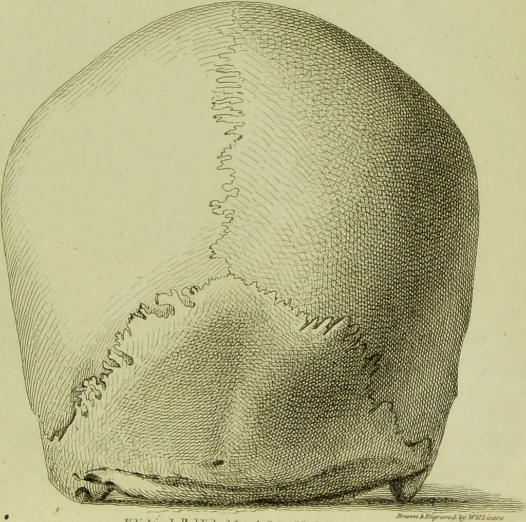 An illustration from Illustrations of phrenology : with engravings / by Sir G. S. Mackenzie., 1820, leaf 309