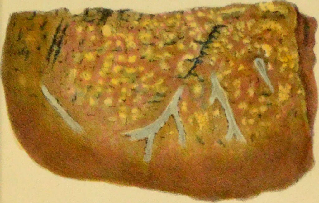An illustration from Illustrations of pulmonary consumption, its anatomical characters, causes, symptoms and treatment. With twelve plates, drawn and coloured from nature / by Samuel George Morton., 1834, leaf 197