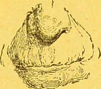 An illustration from La physionomie chez l'homme et chez les animaux, dans ses rapports avec l'expression des émotions et des sentiments / S. Schack., 1887, leaf 135