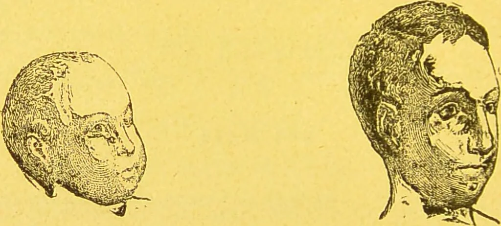 An illustration from La physionomie chez l'homme et chez les animaux, dans ses rapports avec l'expression des émotions et des sentiments / S. Schack., 1887, leaf 154