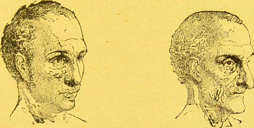 An illustration from La physionomie chez l'homme et chez les animaux, dans ses rapports avec l'expression des émotions et des sentiments / S. Schack., 1887, leaf 155