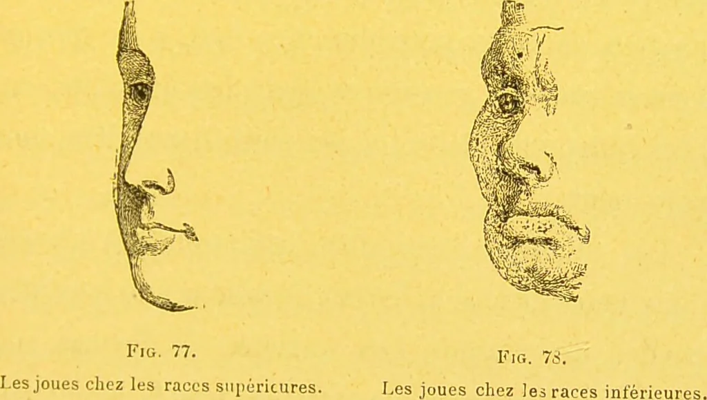 An illustration from La physionomie chez l'homme et chez les animaux, dans ses rapports avec l'expression des émotions et des sentiments / S. Schack., 1887, leaf 157