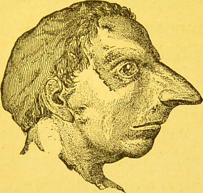 An illustration from La physionomie chez l'homme et chez les animaux, dans ses rapports avec l'expression des émotions et des sentiments / S. Schack., 1887, leaf 365