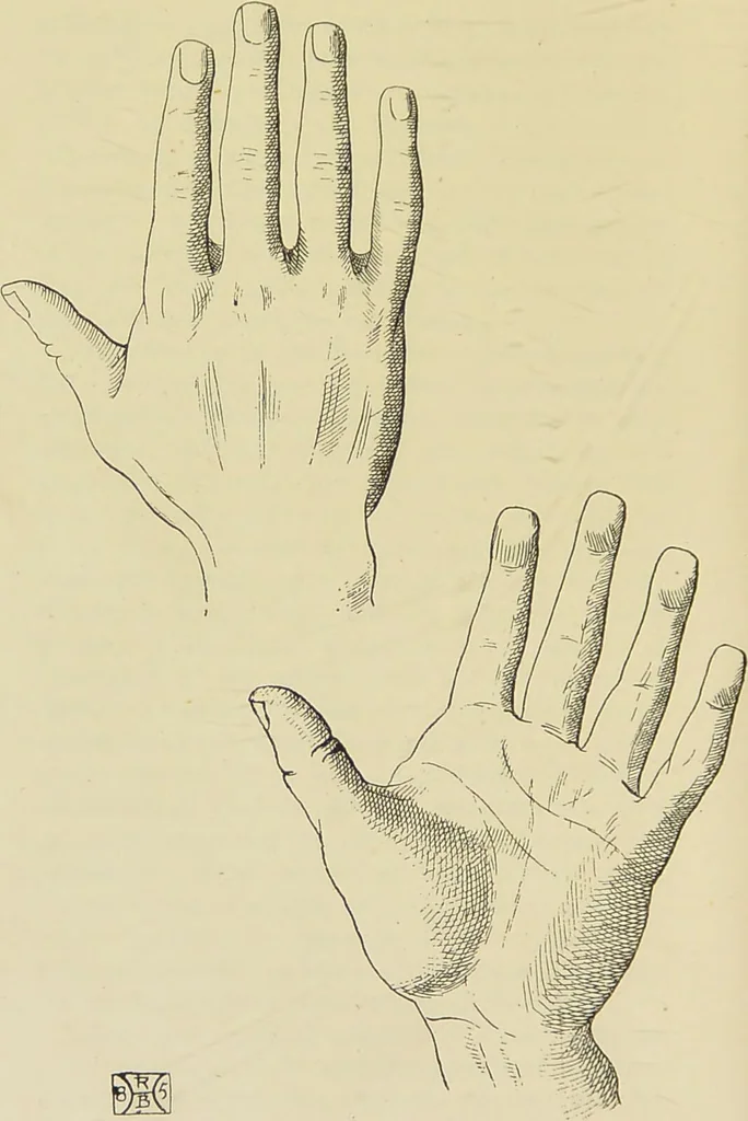 An illustration from A manual of cheirosophy : being a complete practical handbook of the twin sciences of cheirognomy and cheiromancy, by means whereof the past, the present, and the future may be read in the formations of the hands ; preceded by an introductory argument upon the science of cheirosophy and its claims to rank as a physical science / by Ed. Heron-Allen ; with full-page and other illustrations by Rosamund Brunel Horsley., 1885, leaf 162