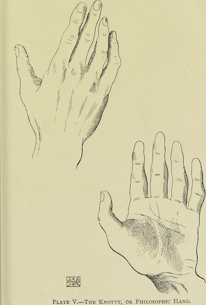 An illustration from A manual of cheirosophy : being a complete practical handbook of the twin sciences of cheirognomy and cheiromancy, by means whereof the past, the present, and the future may be read in the formations of the hands ; preceded by an introductory argument upon the science of cheirosophy and its claims to rank as a physical science / by Ed. Heron-Allen ; with full-page and other illustrations by Rosamund Brunel Horsley., 1885, leaf 169