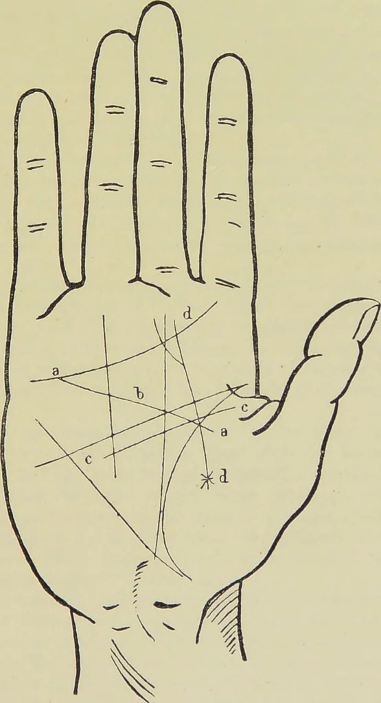 An illustration from A manual of cheirosophy : being a complete practical handbook of the twin sciences of cheirognomy and cheiromancy, by means whereof the past, the present, and the future may be read in the formations of the hands ; preceded by an introductory argument upon the science of cheirosophy and its claims to rank as a physical science / by Ed. Heron-Allen ; with full-page and other illustrations by Rosamund Brunel Horsley., 1885, leaf 303