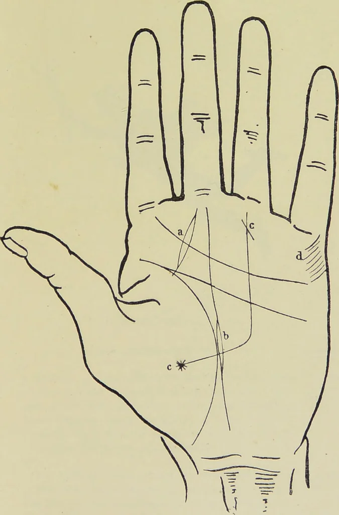 An illustration from A manual of cheirosophy : being a complete practical handbook of the twin sciences of cheirognomy and cheiromancy, by means whereof the past, the present, and the future may be read in the formations of the hands ; preceded by an introductory argument upon the science of cheirosophy and its claims to rank as a physical science / by Ed. Heron-Allen ; with full-page and other illustrations by Rosamund Brunel Horsley., 1885, leaf 307