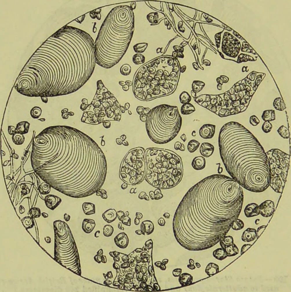 An illustration from The microscope : its history, construction, and application, being a familiar introduction to the use of the instrument, and the study of microscopical science / by Jabez Hogg ; with upwards of five hundred engravings, and coloured illustrations by Tuffen West., 1890, leaf 378