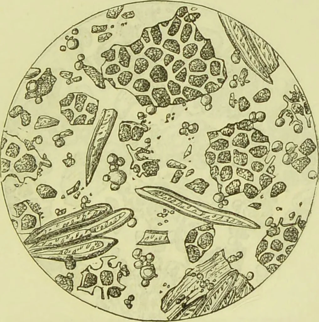 An illustration from The microscope : its history, construction, and application, being a familiar introduction to the use of the instrument, and the study of microscopical science / by Jabez Hogg ; with upwards of five hundred engravings, and coloured illustrations by Tuffen West., 1890, leaf 379