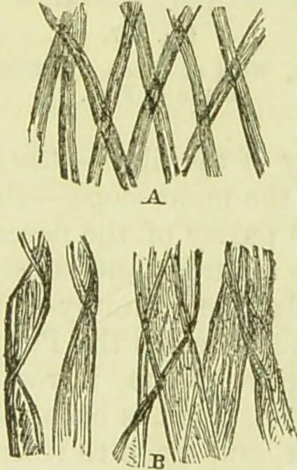 An illustration from The microscope : its history, construction, and application, being a familiar introduction to the use of the instrument, and the study of microscopical science / by Jabez Hogg ; with upwards of five hundred engravings, and coloured illustrations by Tuffen West., 1890, leaf 385
