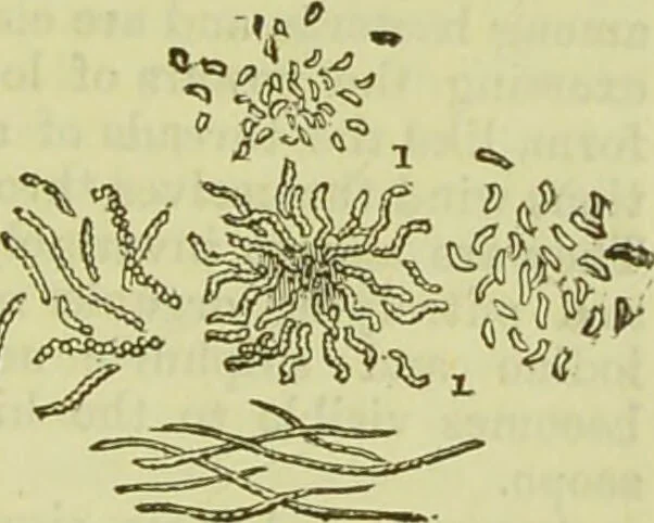 An illustration from The microscope : its history, construction, and application, being a familiar introduction to the use of the instrument, and the study of microscopical science / by Jabez Hogg ; with upwards of five hundred engravings, and coloured illustrations by Tuffen West., 1890, leaf 445