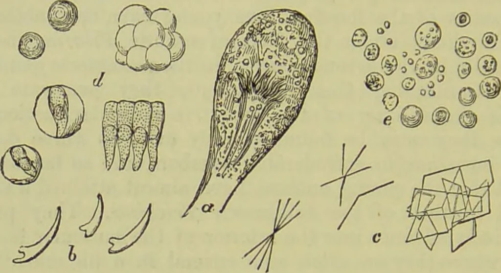 An illustration from The microscope : its history, construction, and application, being a familiar introduction to the use of the instrument, and the study of microscopical science / by Jabez Hogg ; with upwards of five hundred engravings, and coloured illustrations by Tuffen West., 1890, leaf 608