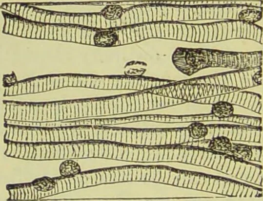 An illustration from The microscope : its history, construction, and application, being a familiar introduction to the use of the instrument, and the study of microscopical science / by Jabez Hogg ; with upwards of five hundred engravings, and coloured illustrations by Tuffen West., 1890, leaf 738