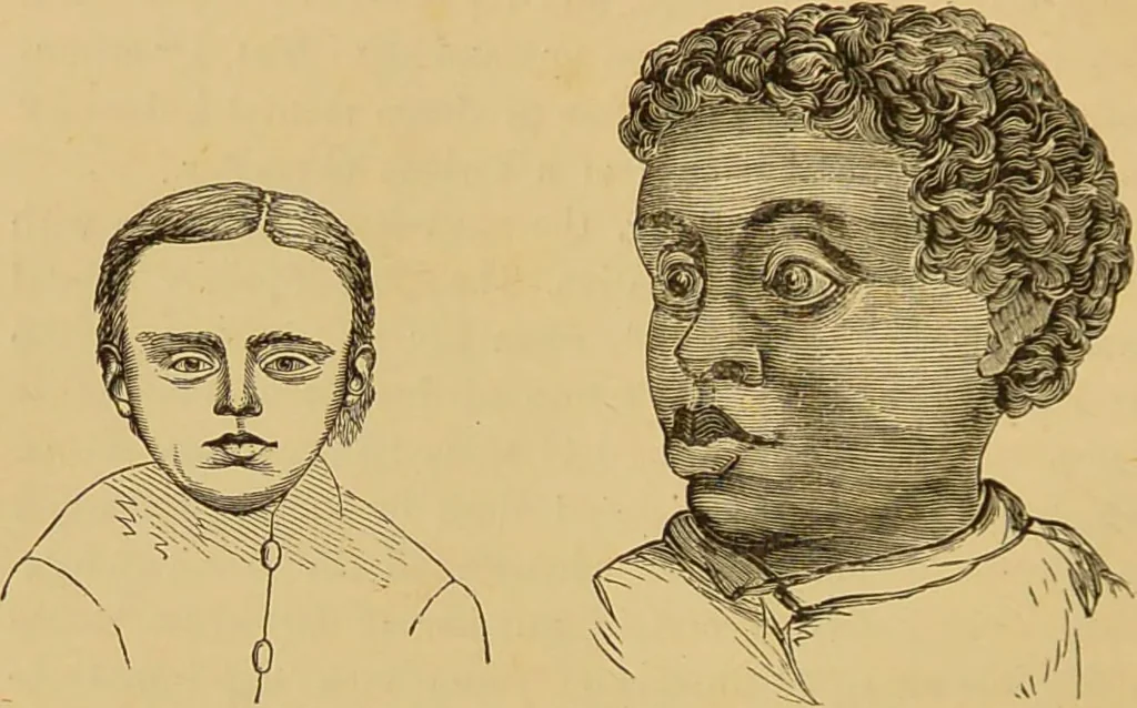 An illustration from Nature's revelations of character, or, The mental, moral and volitive dispositions of mankind, as manifested in the human form and countenance / by Joseph Simms., 1873, leaf 310