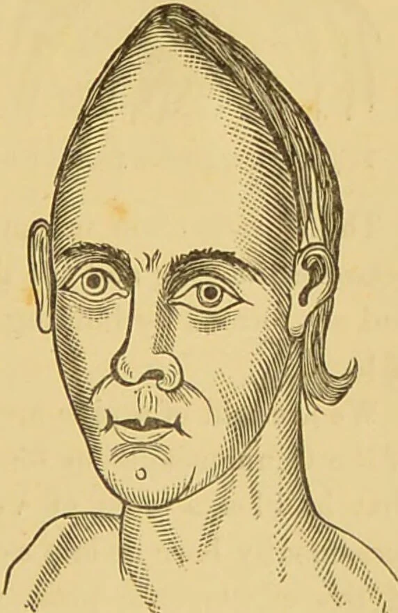 An illustration from Nature's revelations of character, or, The mental, moral and volitive dispositions of mankind, as manifested in the human form and countenance / by Joseph Simms., 1873, leaf 535