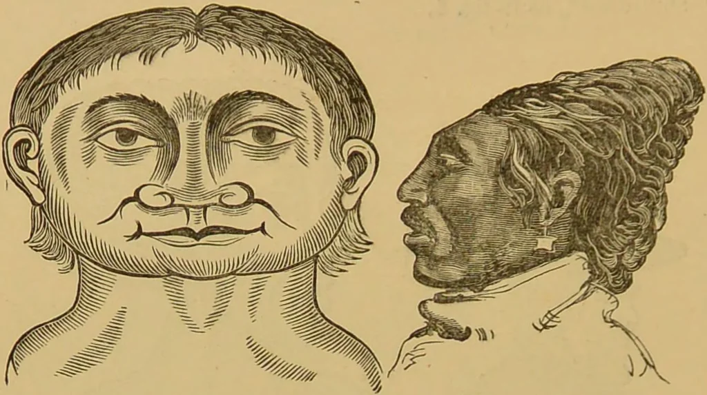 An illustration from Nature's revelations of character, or, The mental, moral and volitive dispositions of mankind, as manifested in the human form and countenance / by Joseph Simms., 1873, leaf 538