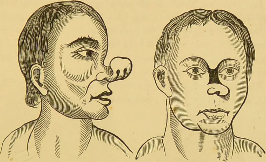 An illustration from Nature's revelations of character, or, The mental, moral and volitive dispositions of mankind, as manifested in the human form and countenance / by Joseph Simms., 1873, leaf 541