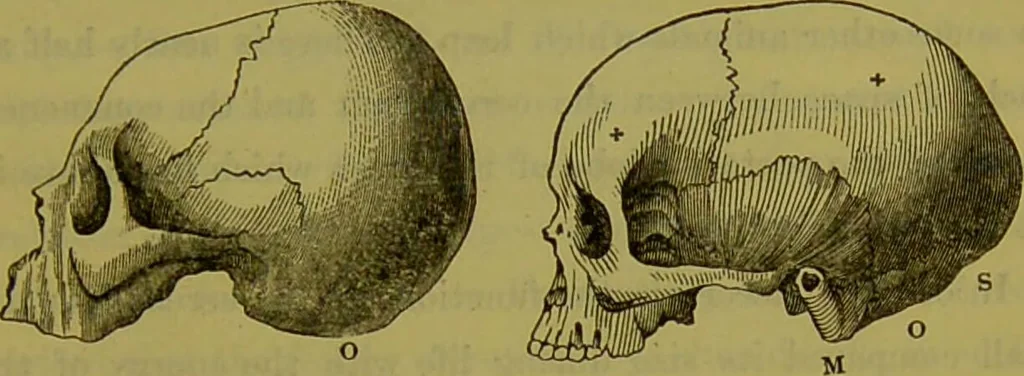 An illustration from On the functions of the cerebellum / by Drs. Gall, Vimont, and Broussais ; translated from the French by George Combe: also answers to the objections urged against phrenology by Drs. Roget, Rudolphi, Prichard, and Tiedemann; by George Combe and A. Combe., 1838, leaf 19