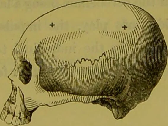 An illustration from On the functions of the cerebellum / by Drs. Gall, Vimont, and Broussais ; translated from the French by George Combe: also answers to the objections urged against phrenology by Drs. Roget, Rudolphi, Prichard, and Tiedemann; by George Combe and A. Combe., 1838, leaf 19