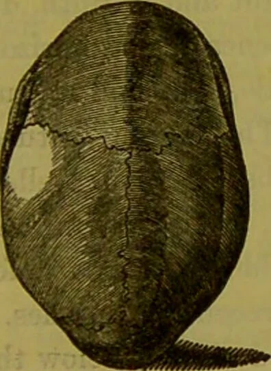 An illustration from On the functions of the cerebellum / by Drs. Gall, Vimont, and Broussais ; translated from the French by George Combe: also answers to the objections urged against phrenology by Drs. Roget, Rudolphi, Prichard, and Tiedemann; by George Combe and A. Combe., 1838, leaf 201