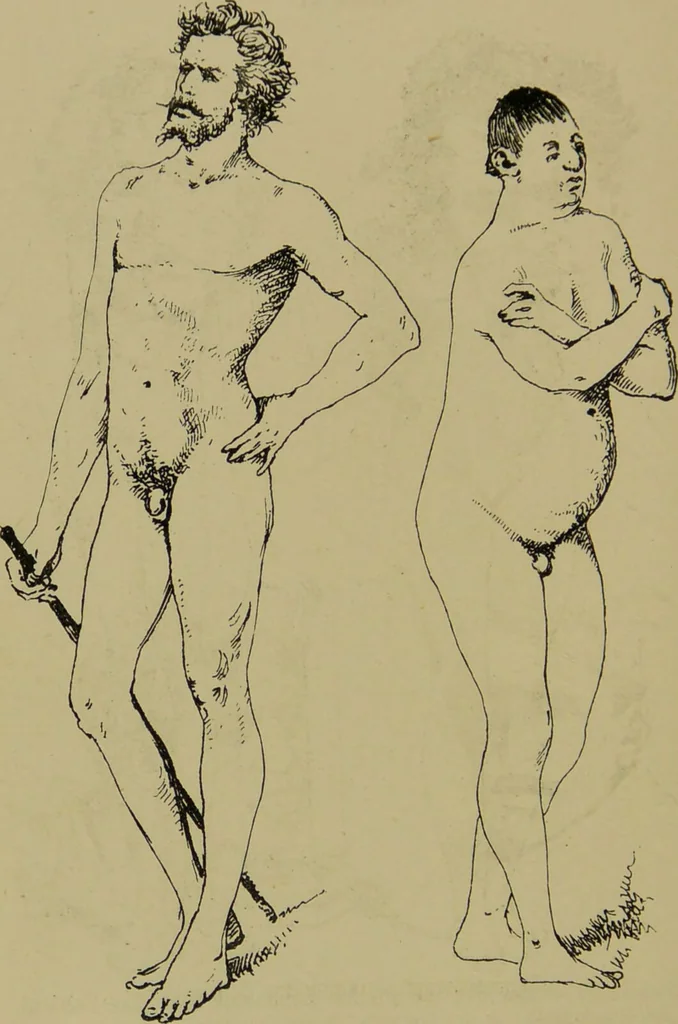 An illustration from Physiognomik und Mimik / von Paolo Mantegazza ; mit mehr als hundert original-zeichmungen von Hector und Edward Ximenes ; vom verfasser genehmigte übersetzung von R. Löwenfeld., 1890, leaf 156