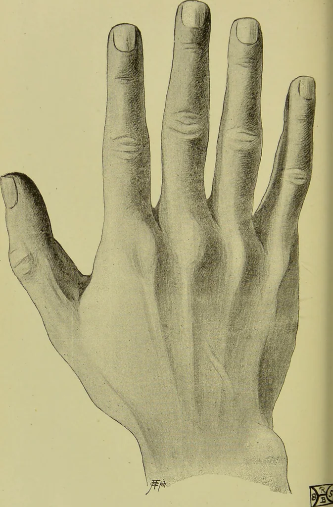 An illustration from The science of the hand, or, The art of recognising the tendencies of the human mind by the observation of the formations of the hands = la science de la main / translated from the French of C.S. D'Arpentigny and edited ... by Ed. Heron-Allen ; with original plates and explanatory diagrams by Rosamund Brunel Horsley., 1886, leaf 338