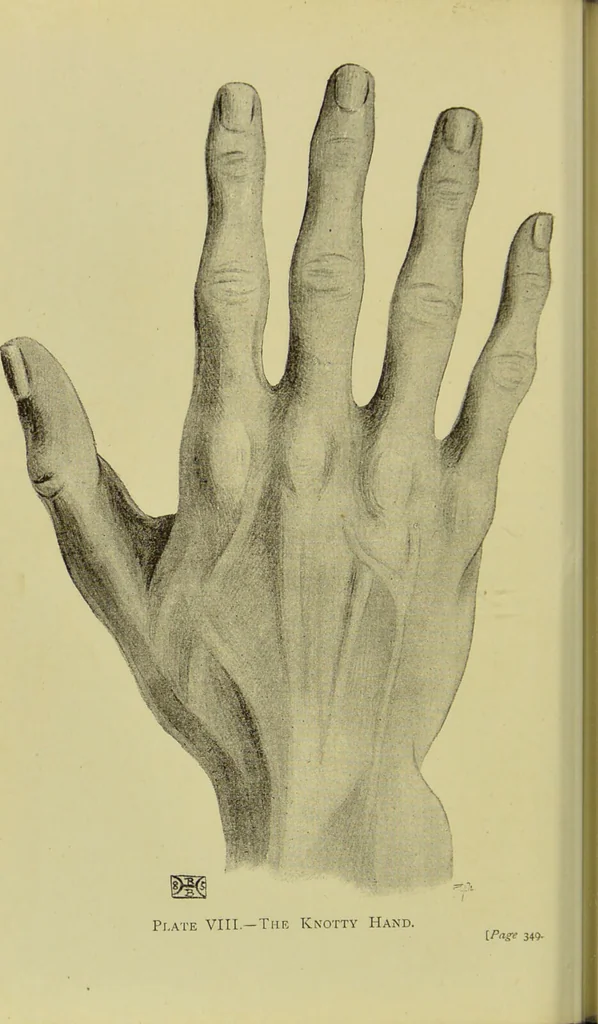 An illustration from The science of the hand, or, The art of recognising the tendencies of the human mind by the observation of the formations of the hands = la science de la main / translated from the French of C.S. D'Arpentigny and edited ... by Ed. Heron-Allen ; with original plates and explanatory diagrams by Rosamund Brunel Horsley., 1886, leaf 370