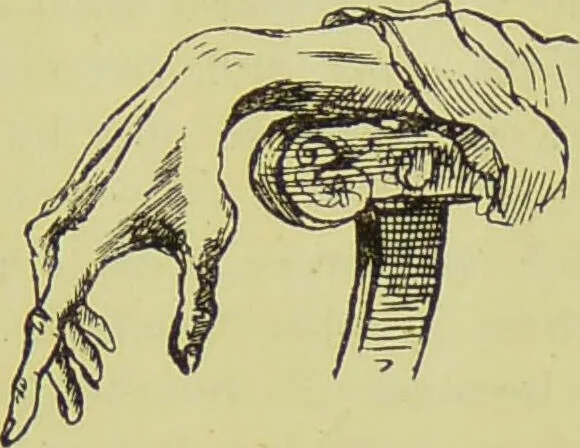 An illustration from The science of the hand, or, The art of recognising the tendencies of the human mind by the observation of the formations of the hands = la science de la main / translated from the French of C.S. D'Arpentigny and edited ... by Ed. Heron-Allen ; with original plates and explanatory diagrams by Rosamund Brunel Horsley., 1886, leaf 411