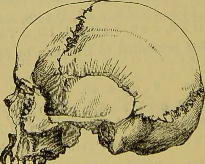 An illustration from Thesaurus craniorum : catalogue of the skulls of the various races of man, in the collection of Joseph Barnard Davis., 1867, leaf 168