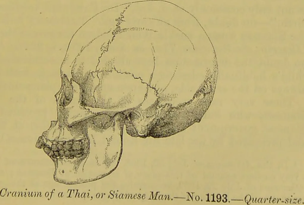 An illustration from Thesaurus craniorum : catalogue of the skulls of the various races of man, in the collection of Joseph Barnard Davis., 1867, leaf 197