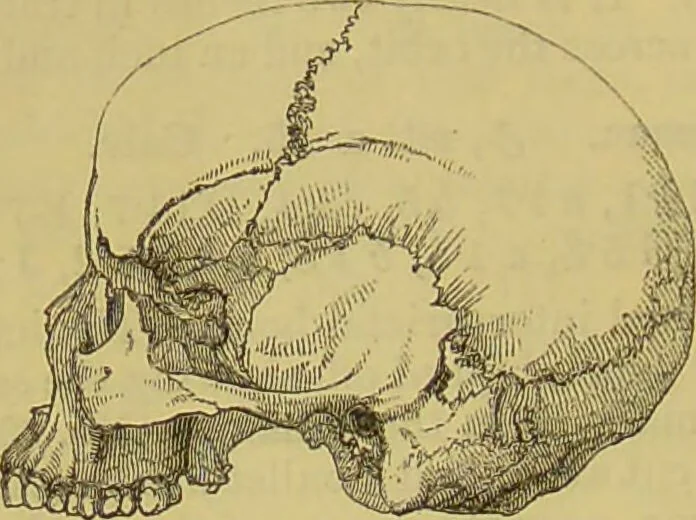 An illustration from Thesaurus craniorum : catalogue of the skulls of the various races of man, in the collection of Joseph Barnard Davis., 1867, leaf 226