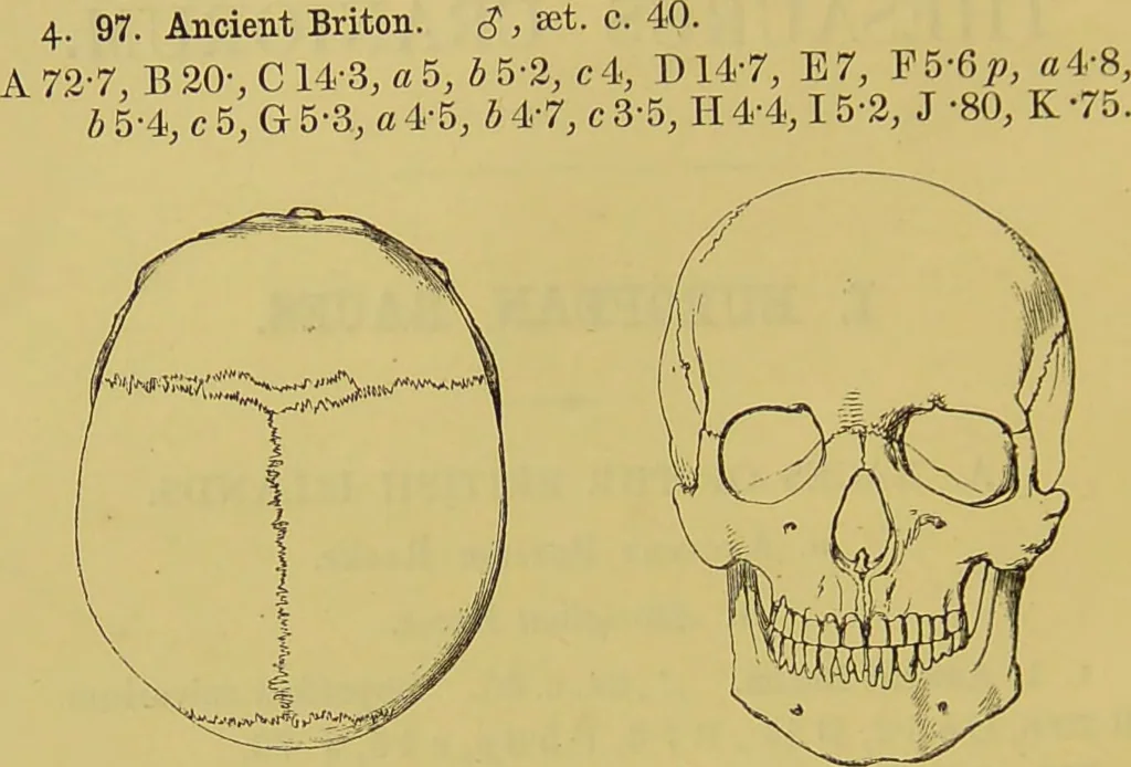 An illustration from Thesaurus craniorum : catalogue of the skulls of the various races of man, in the collection of Joseph Barnard Davis., 1867, leaf 24