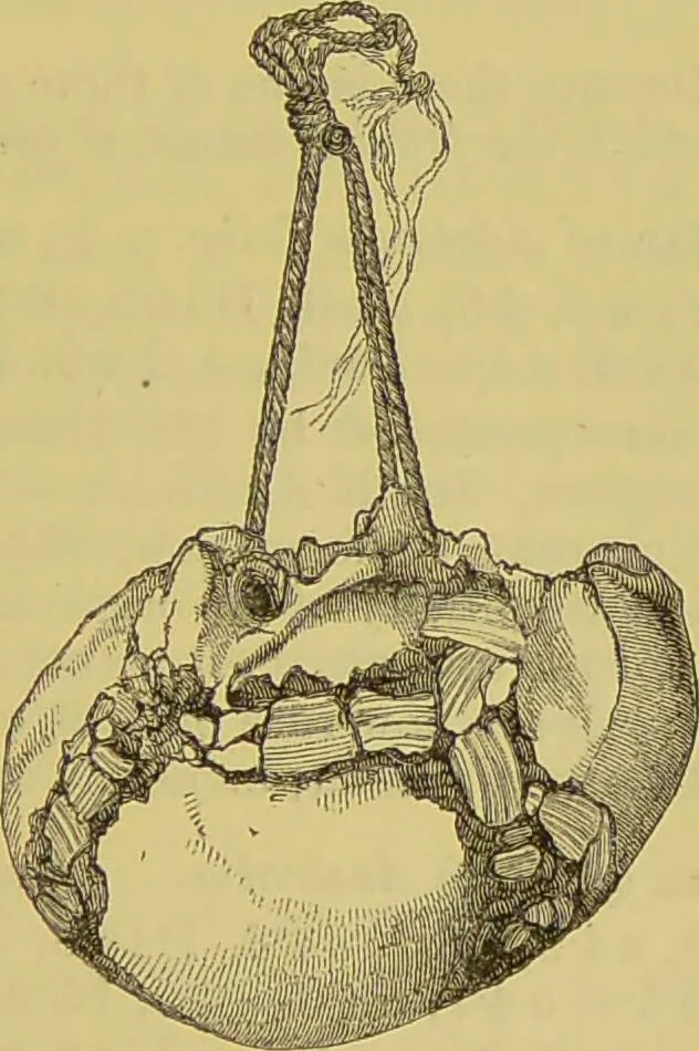 An illustration from Thesaurus craniorum : catalogue of the skulls of the various races of man, in the collection of Joseph Barnard Davis., 1867, leaf 281