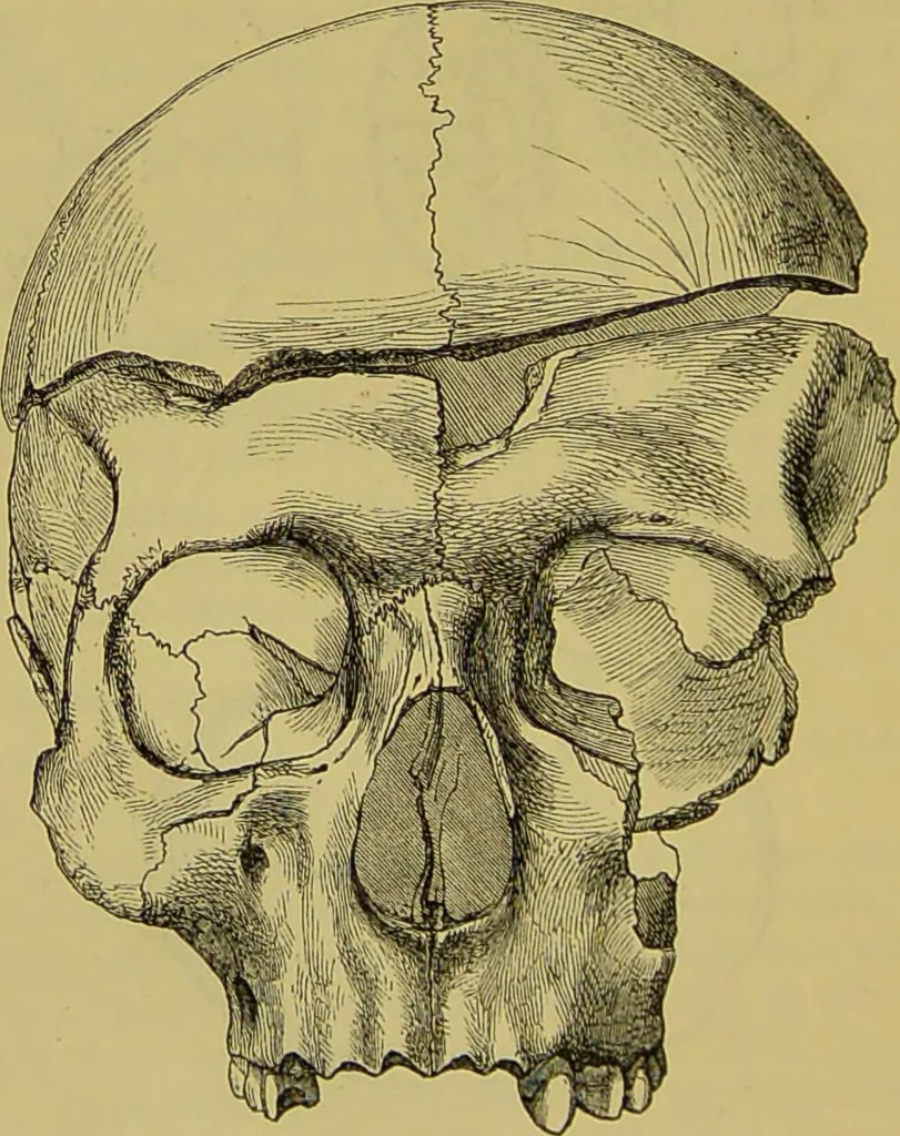 An illustration from Thesaurus craniorum : catalogue of the skulls of the various races of man, in the collection of Joseph Barnard Davis., 1867, leaf 30
