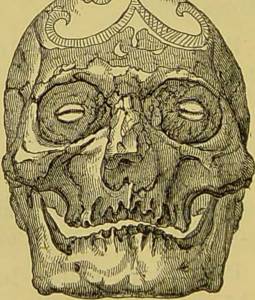 An illustration from Thesaurus craniorum : catalogue of the skulls of the various races of man, in the collection of Joseph Barnard Davis., 1867, leaf 318