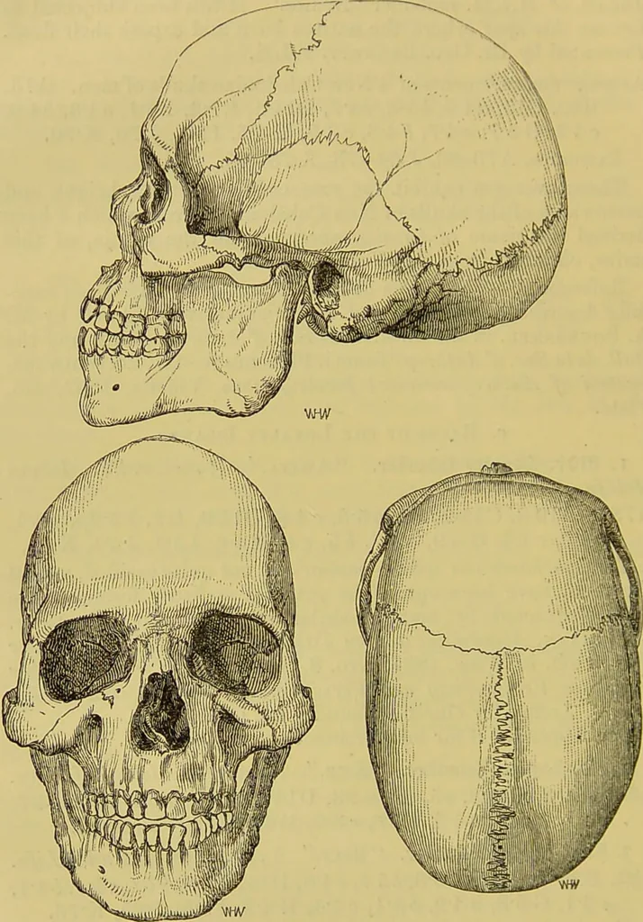 An illustration from Thesaurus craniorum : catalogue of the skulls of the various races of man, in the collection of Joseph Barnard Davis., 1867, leaf 332