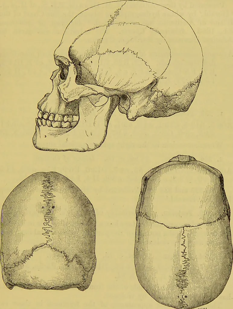 An illustration from Thesaurus craniorum : catalogue of the skulls of the various races of man, in the collection of Joseph Barnard Davis., 1867, leaf 335
