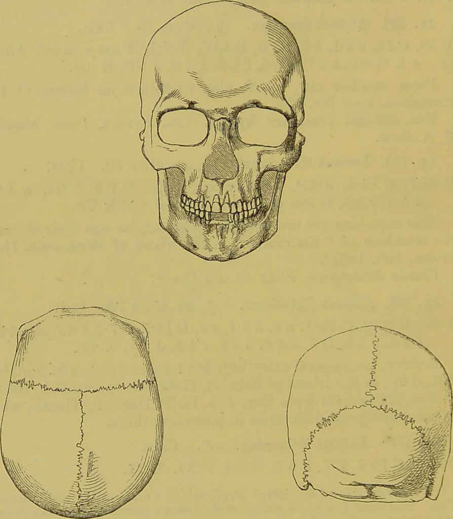 An illustration from Thesaurus craniorum : catalogue of the skulls of the various races of man, in the collection of Joseph Barnard Davis., 1867, leaf 36