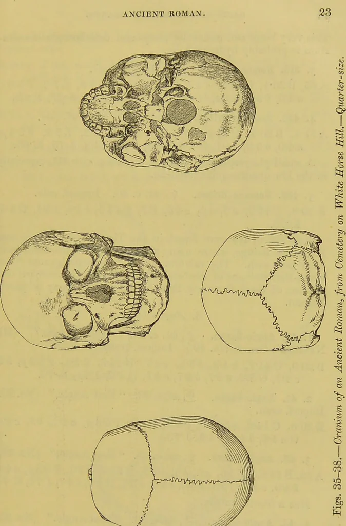 An illustration from Thesaurus craniorum : catalogue of the skulls of the various races of man, in the collection of Joseph Barnard Davis., 1867, leaf 45