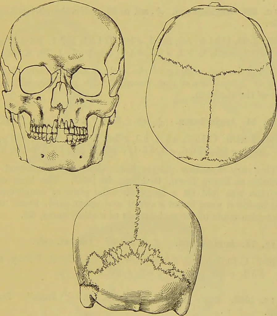 An illustration from Thesaurus craniorum : catalogue of the skulls of the various races of man, in the collection of Joseph Barnard Davis., 1867, leaf 47
