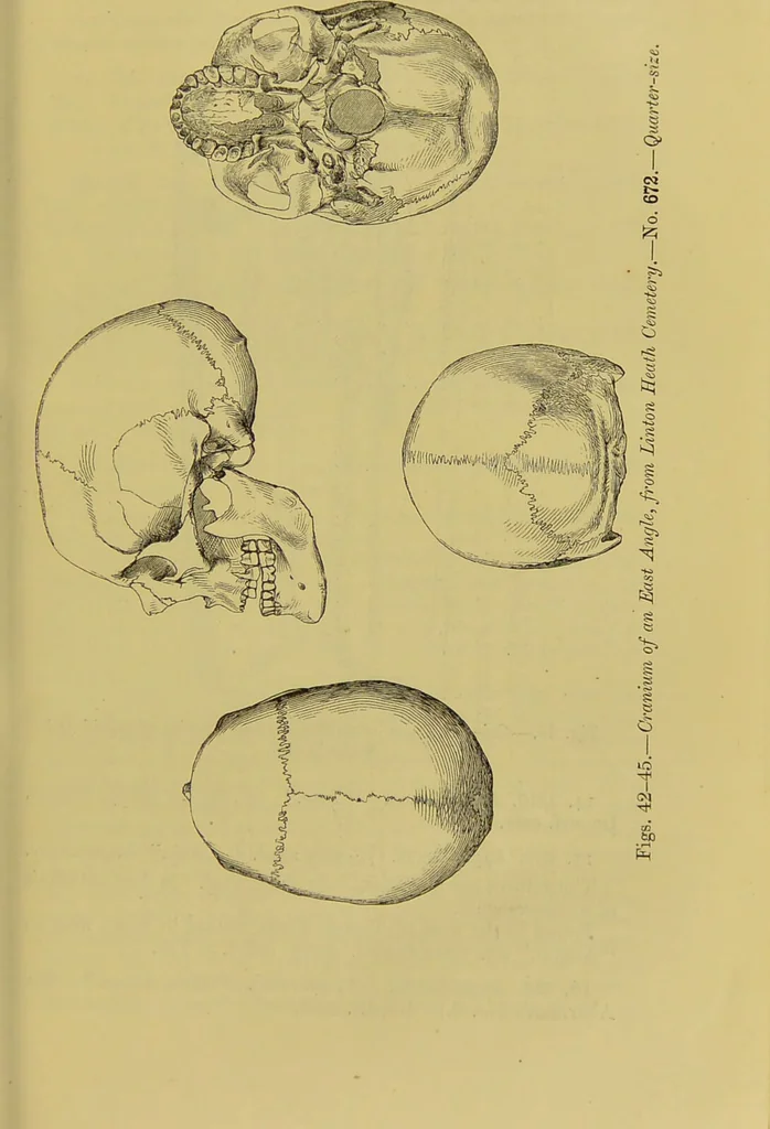 An illustration from Thesaurus craniorum : catalogue of the skulls of the various races of man, in the collection of Joseph Barnard Davis., 1867, leaf 49