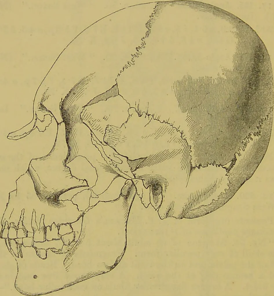 An illustration from Thesaurus craniorum : catalogue of the skulls of the various races of man, in the collection of Joseph Barnard Davis., 1867, leaf 52