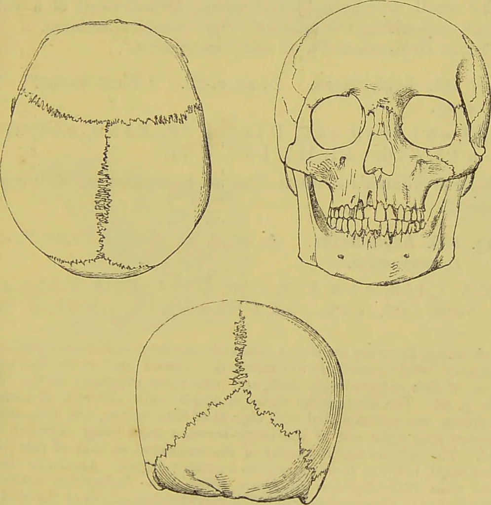 An illustration from Thesaurus craniorum : catalogue of the skulls of the various races of man, in the collection of Joseph Barnard Davis., 1867, leaf 53