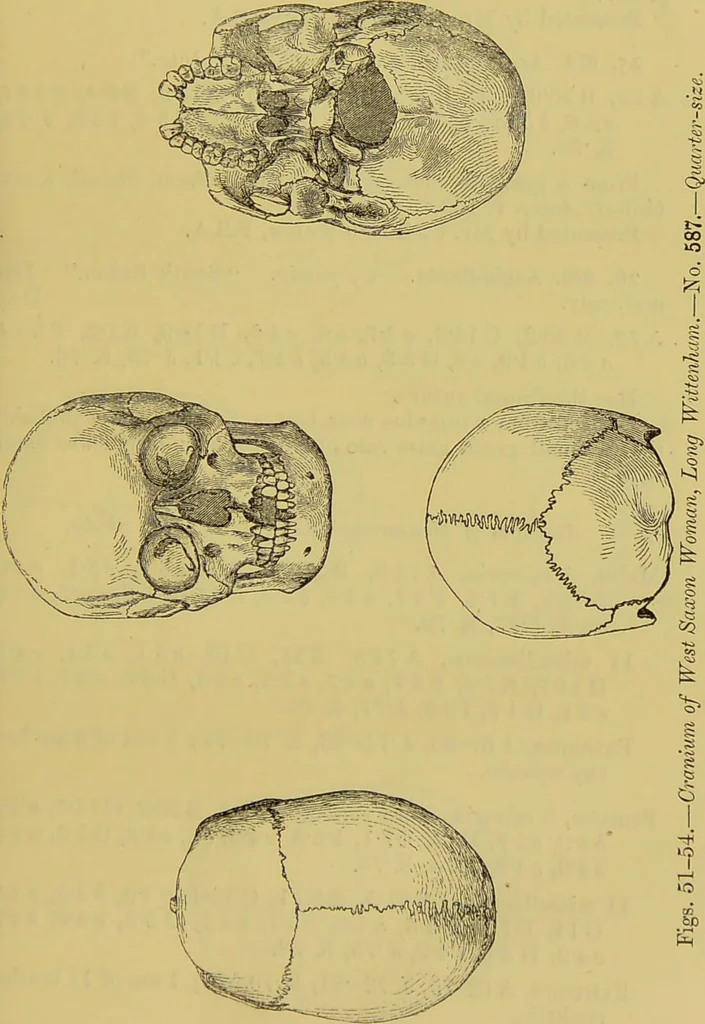 An illustration from Thesaurus craniorum : catalogue of the skulls of the various races of man, in the collection of Joseph Barnard Davis., 1867, leaf 55