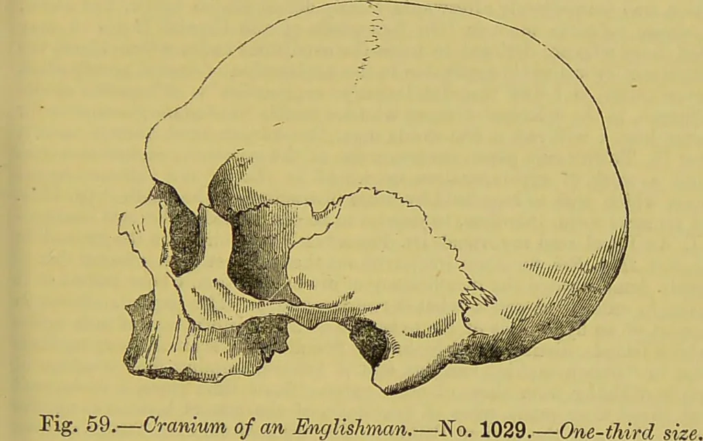 An illustration from Thesaurus craniorum : catalogue of the skulls of the various races of man, in the collection of Joseph Barnard Davis., 1867, leaf 71