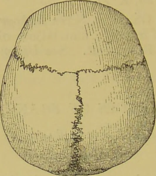 An illustration from Thesaurus craniorum : catalogue of the skulls of the various races of man, in the collection of Joseph Barnard Davis., 1867, leaf 94