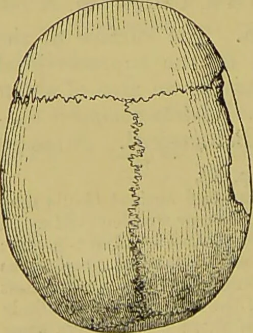 An illustration from Thesaurus craniorum : catalogue of the skulls of the various races of man, in the collection of Joseph Barnard Davis., 1867, leaf 94