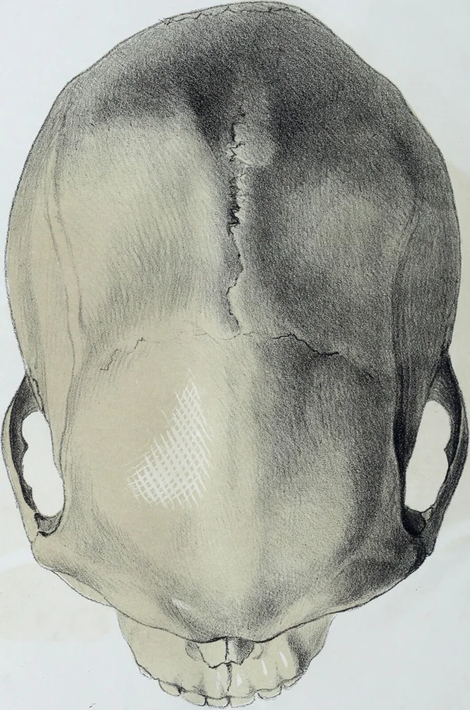 An illustration from Zur Morphologie der Rassen-Schädel : einleitende Bemerkungen und Beiträge, ein Sendschreiben an ... Carl Ernst v. Baer / von Joh. Christ. Gustav Lucae., 1861, leaf 116