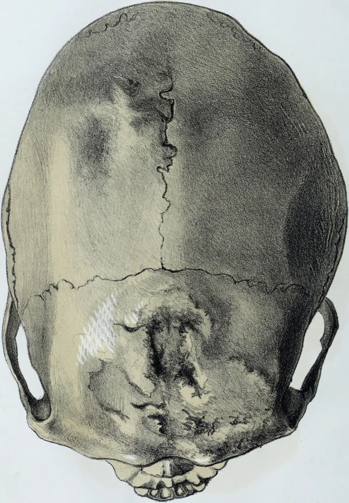 An illustration from Zur Morphologie der Rassen-Schädel : einleitende Bemerkungen und Beiträge, ein Sendschreiben an ... Carl Ernst v. Baer / von Joh. Christ. Gustav Lucae., 1861, leaf 128